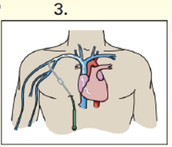 Option C