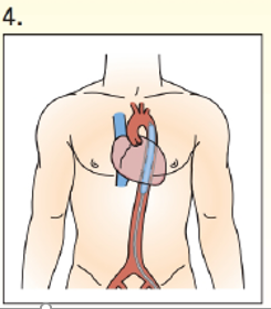 Option D