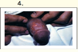 Option D